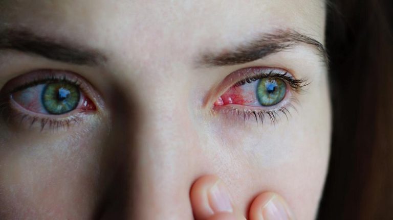 Eye Health Tips – How to Prevent Eye Diseases