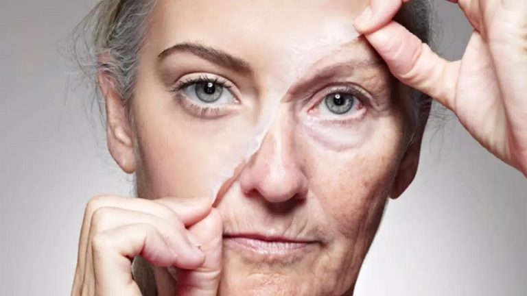 How to Prevent Wrinkles Naturally